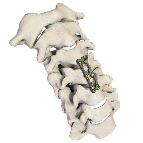 Placa cervical anterior ARIES-III