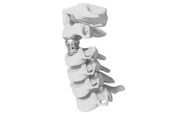 Jaula lumbar expandible Stryker