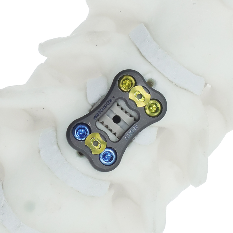 Placa cervical anterior NovaFix-I