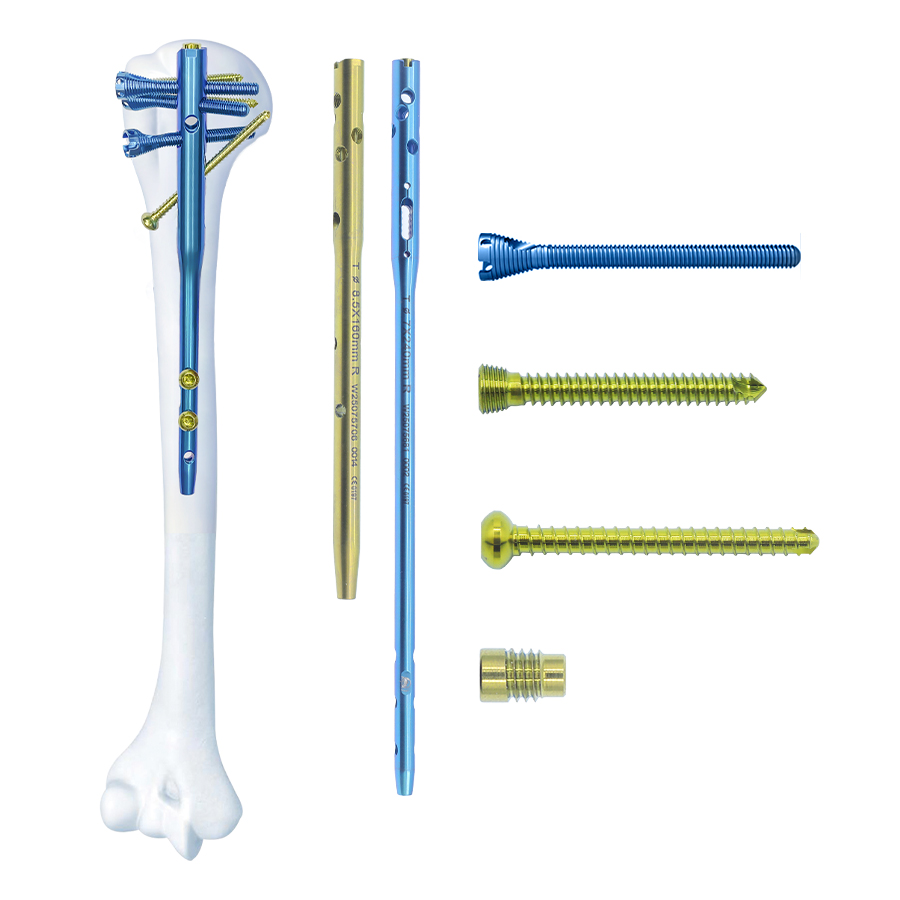 CZMEDITECH Humeral multibloqueo Sistema de clavos intramedulares