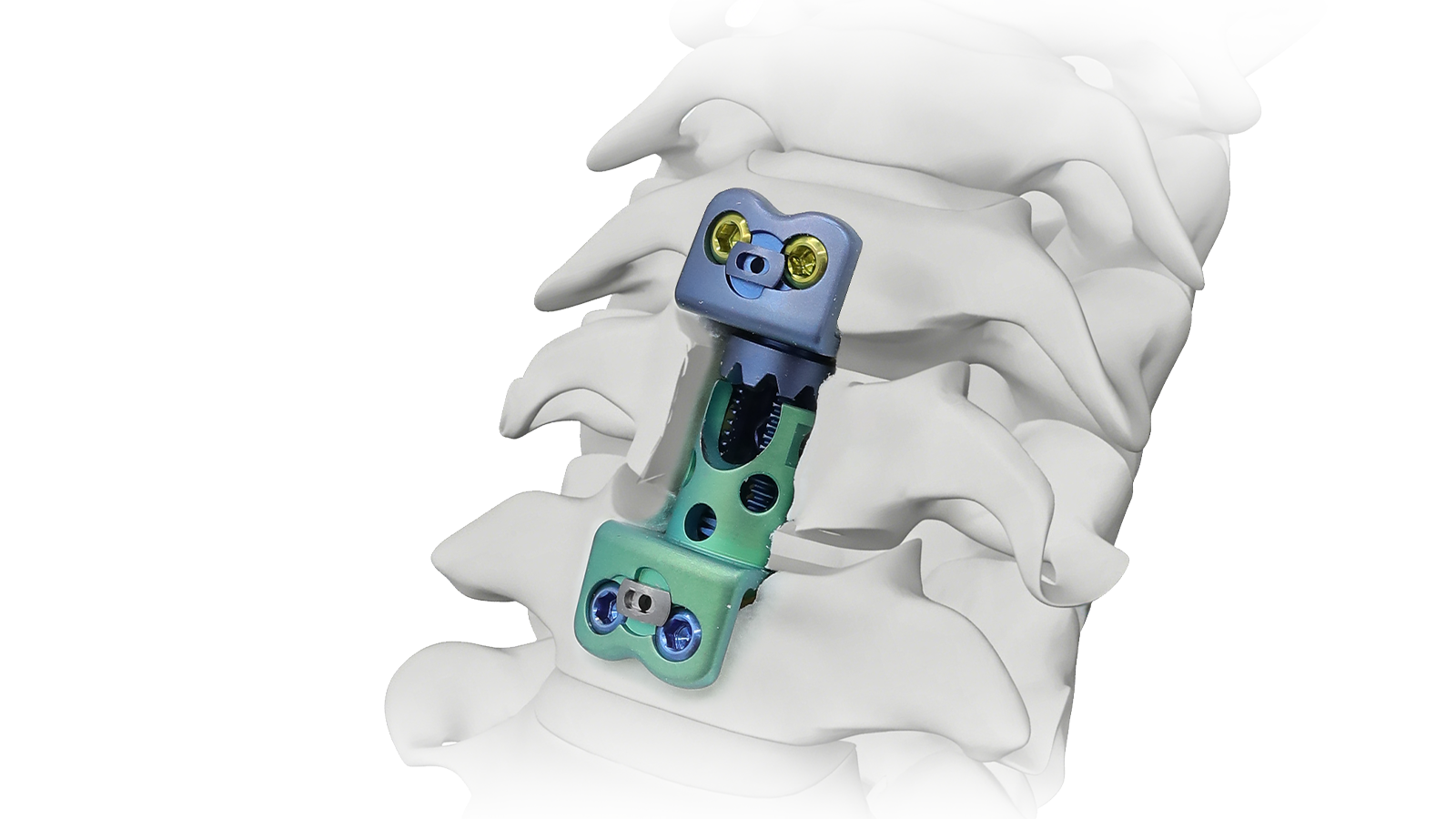 Sistema de reemplazo del cuerpo vertebral