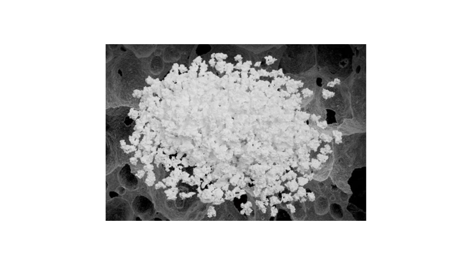 Sustituto óseo de biocerámica — BC.Gr.0001 — d(mm): 0.2～1.0 w(g): 0.25