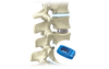 Jaula lumbar PLIF de titanio