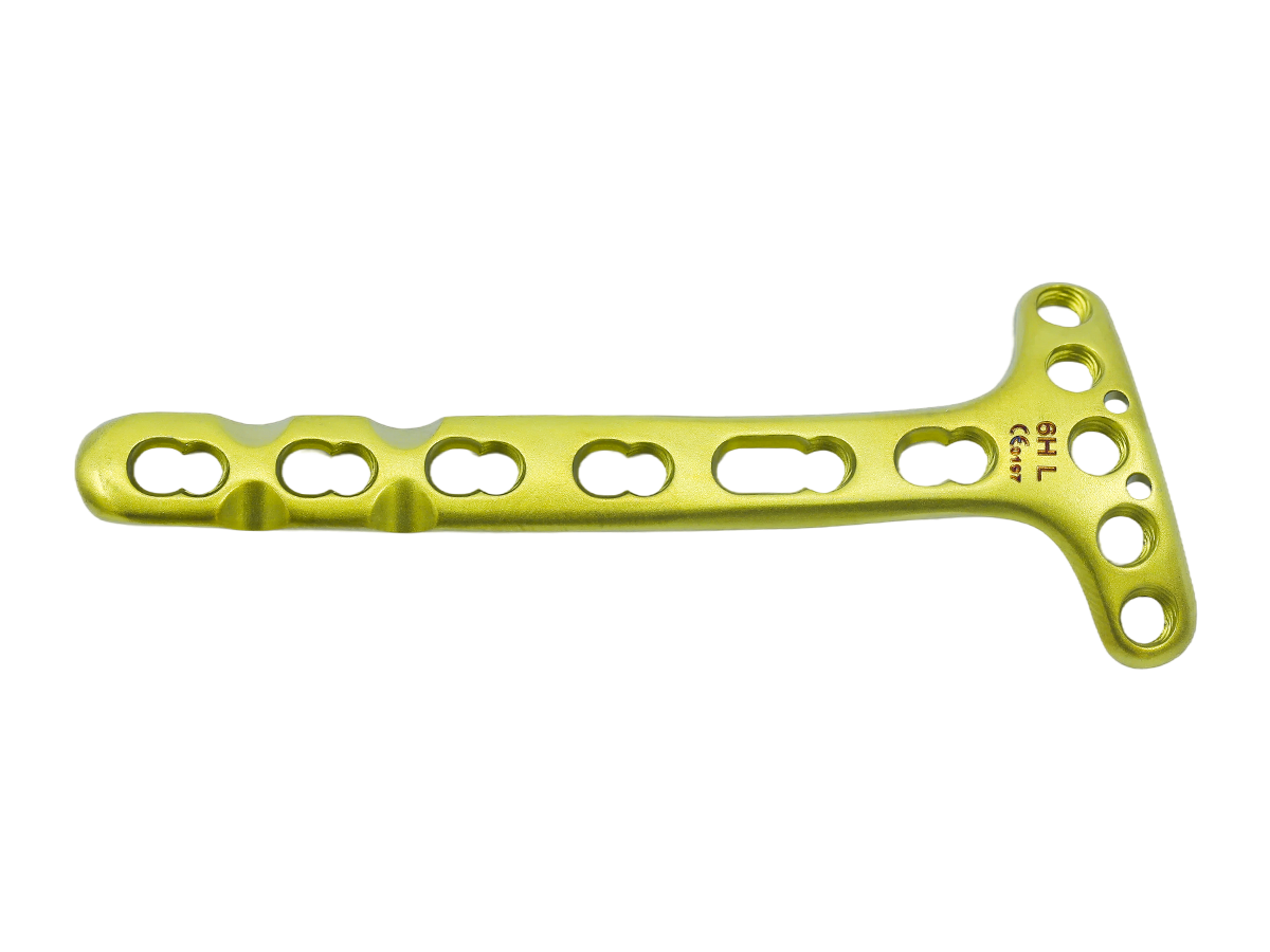Distal Dorsal Radial Delta Placa de bloqueo - Diseño II CZMEDITECH