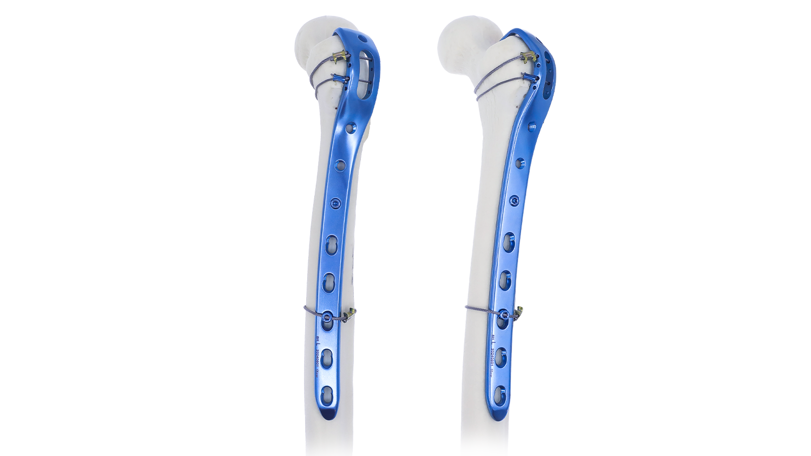 Lower Extremity locking plate system