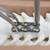 Placa cervical anterior ARIES-III