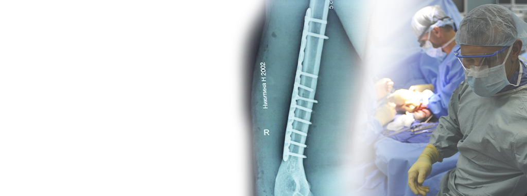 Fractura de la di&aacute;fisis humeral derecha tratada con 